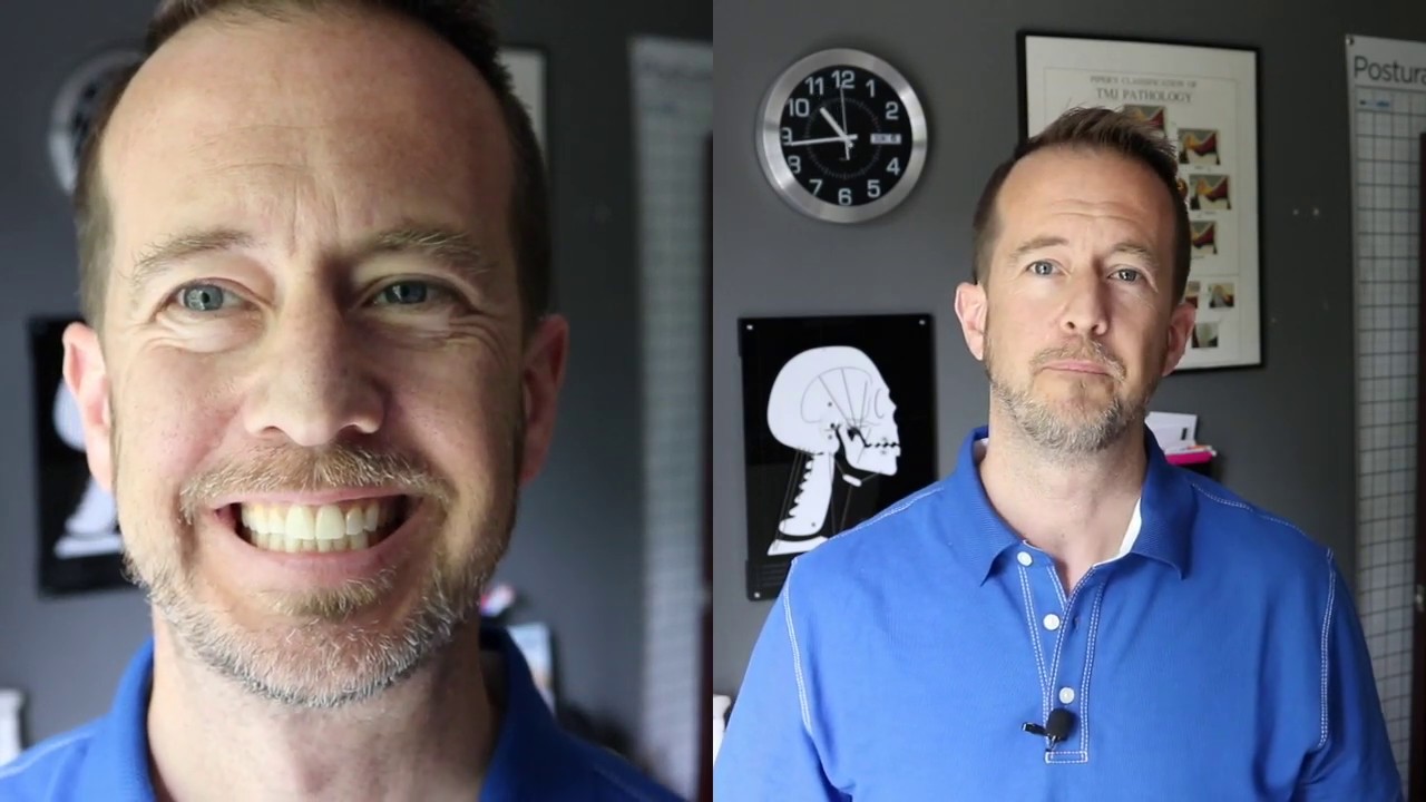 Locked Jaw Solution Part 2: The 'Dolgos' Maneuvre?