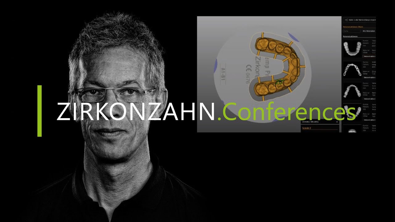 Immediate restorations with Zirkonzahn.Modifier & the Double Milling | Zirkonzahn.Conferences