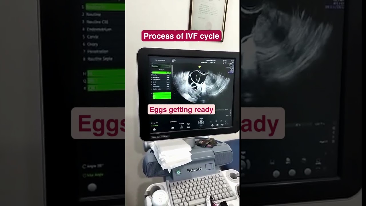 And that&rsquo;s how the parenthood happiness of lakhs of couples starts at Indira IVF!