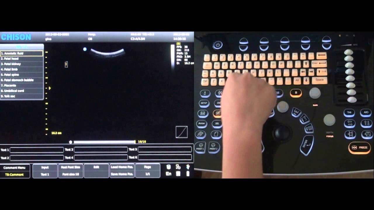 Chison ECO3 Portable Ultrasound | Setup Tutorial