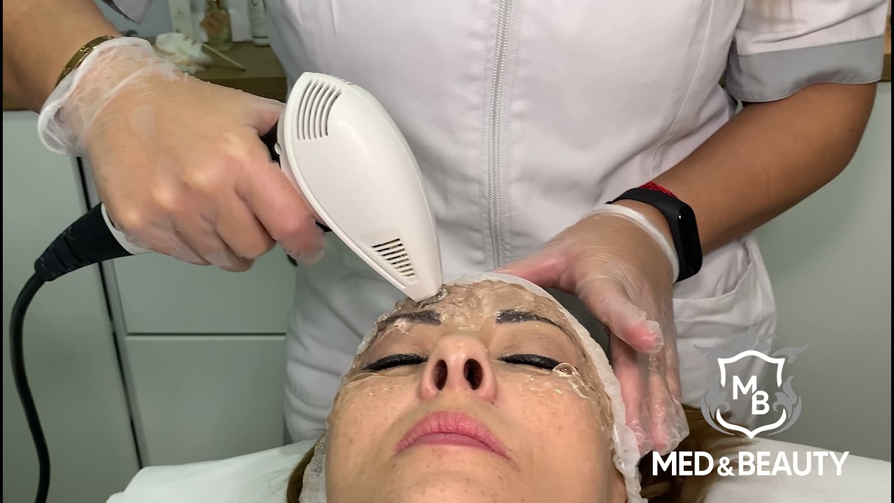Tratamiento de Radiofrecuencia Facial VIORA