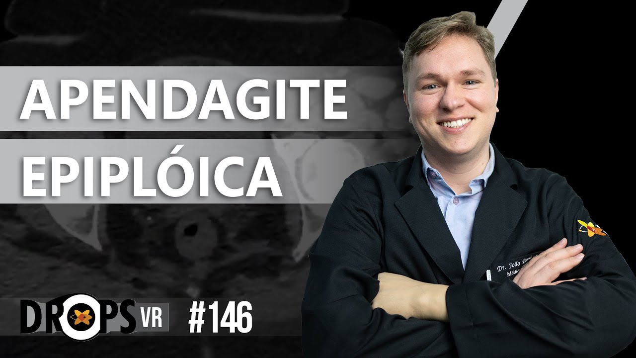 APENDAGITE EPIPL&Oacute;ICA - PASSO A PASSO PARA RECONHECER