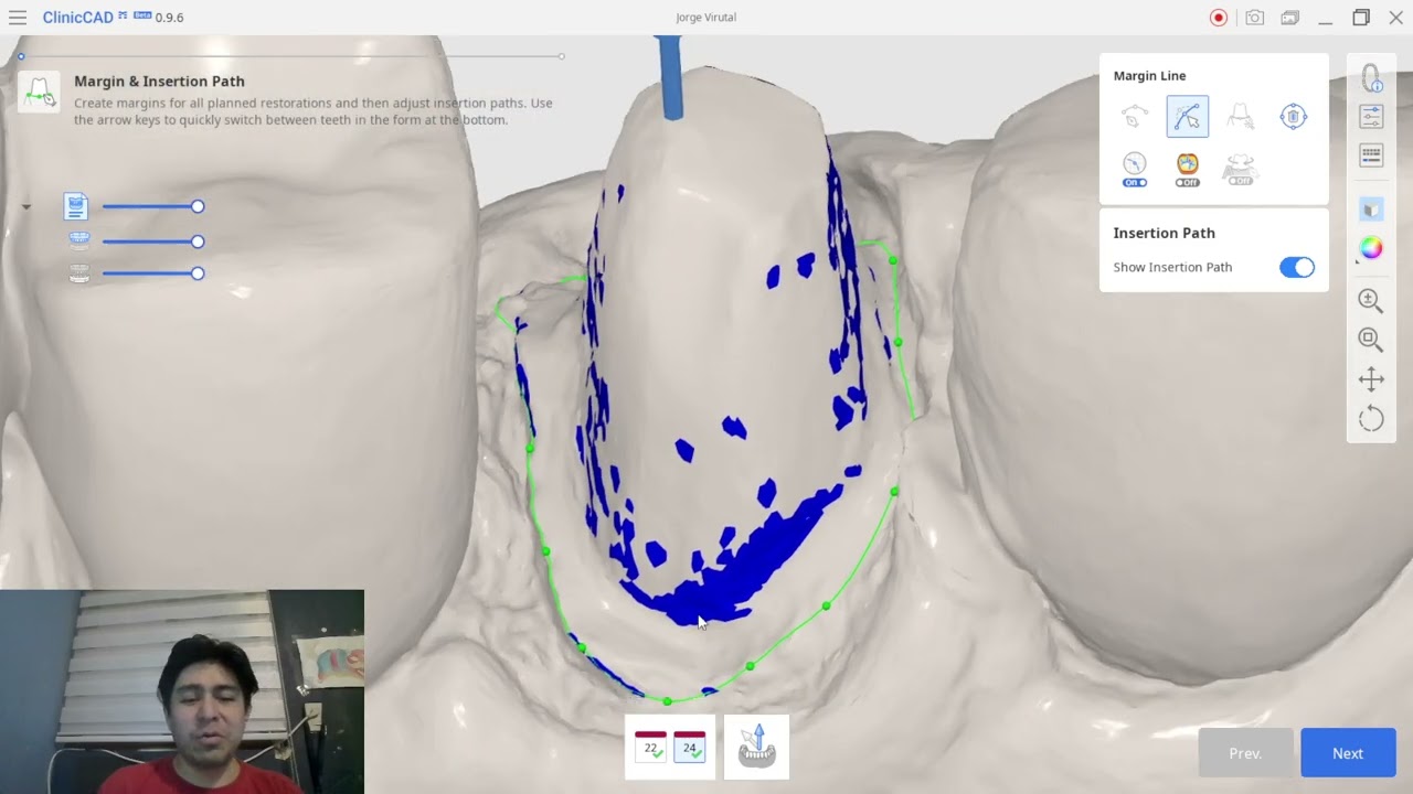 Tutorial Medit ClinicCAD | COFIAS