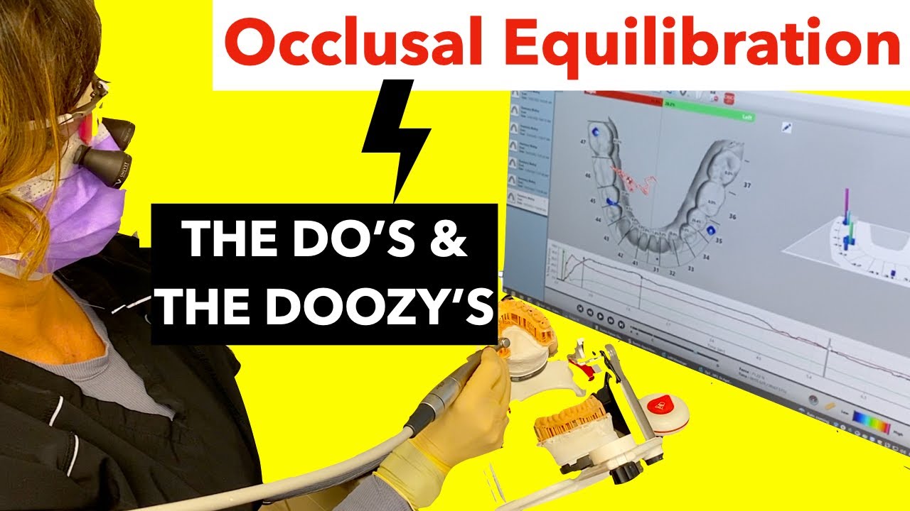 Occlusal Equilibration: Steps & Challenges