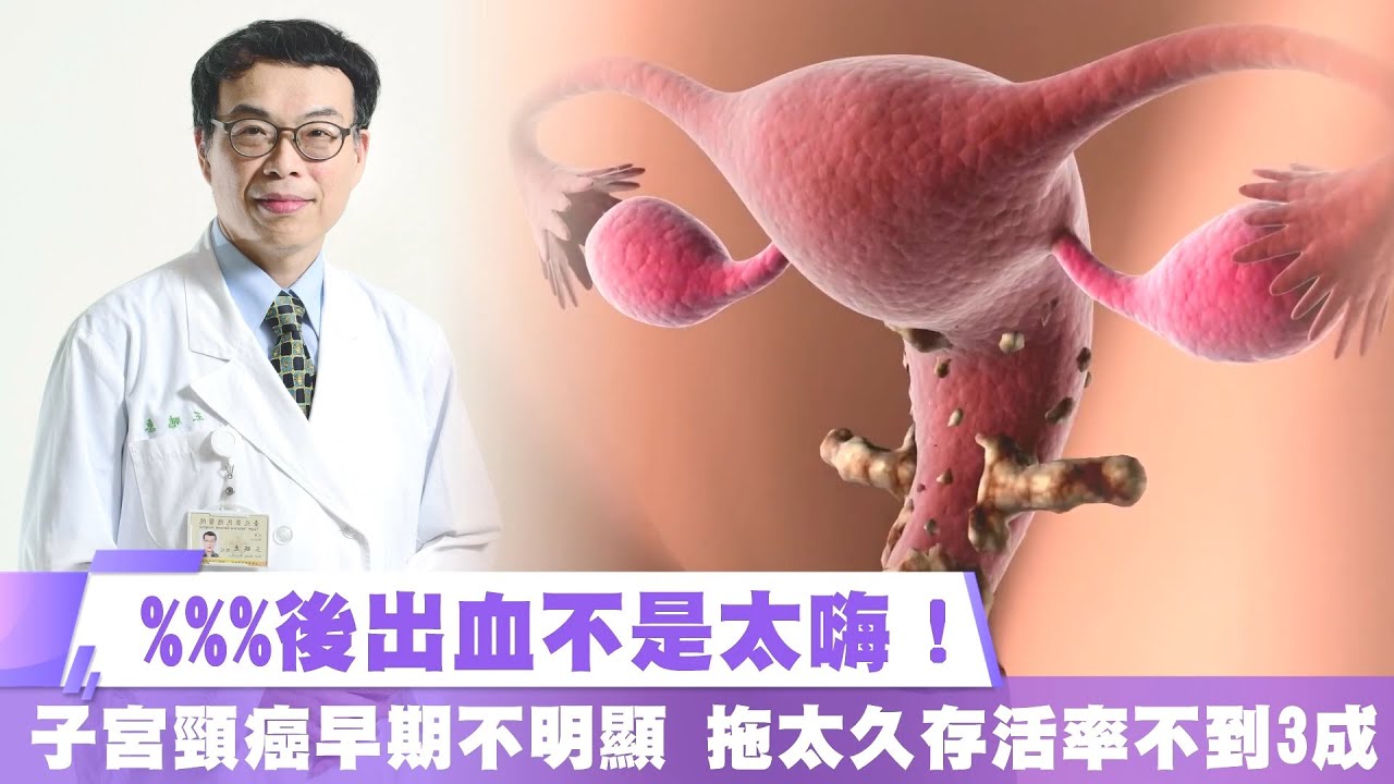 %%%後出血不是太嗨！子宮頸癌早期不明顯 拖太久存活率不到3成｜壹蘋新聞網