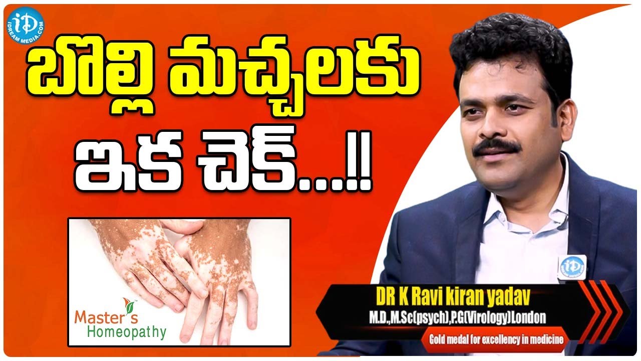 Treatment For Vitiligo Spots... | Dr.k.Ravi Kiran Yadav | Masters Homeopathy | iDream Media