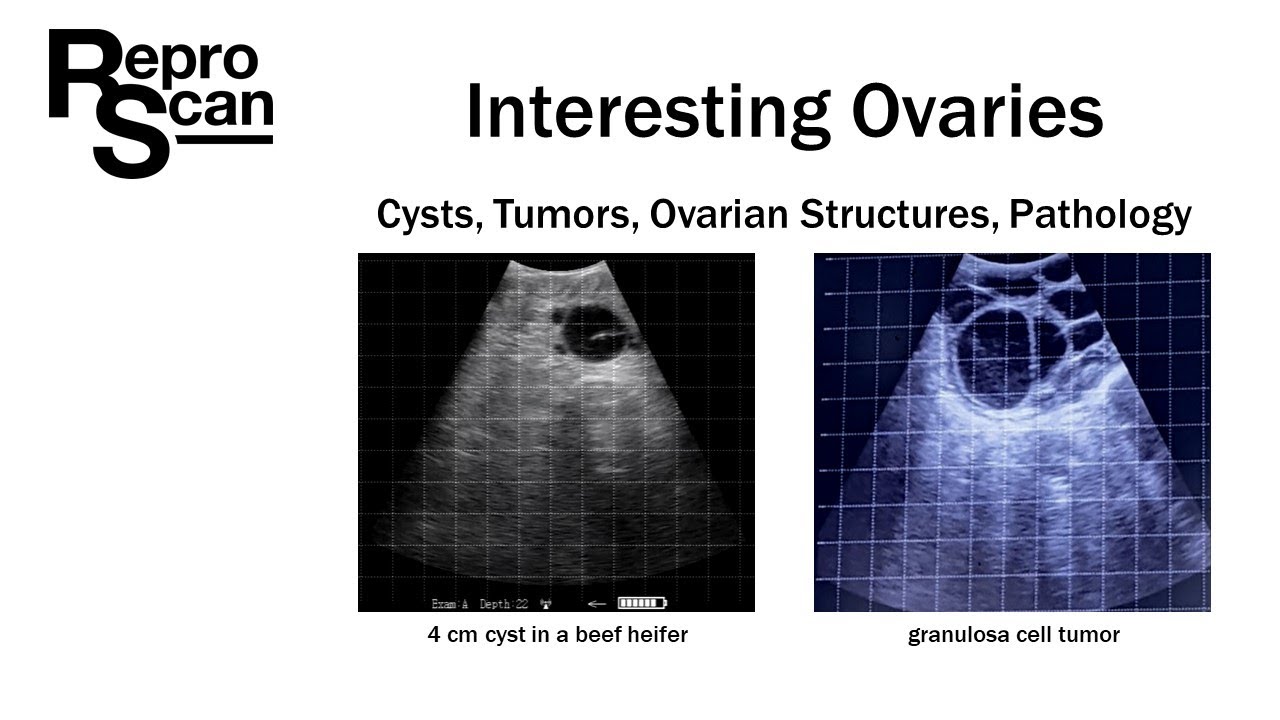 Interesting Ovaries - At look at cysts, tumors, ovarian structures and pathology.