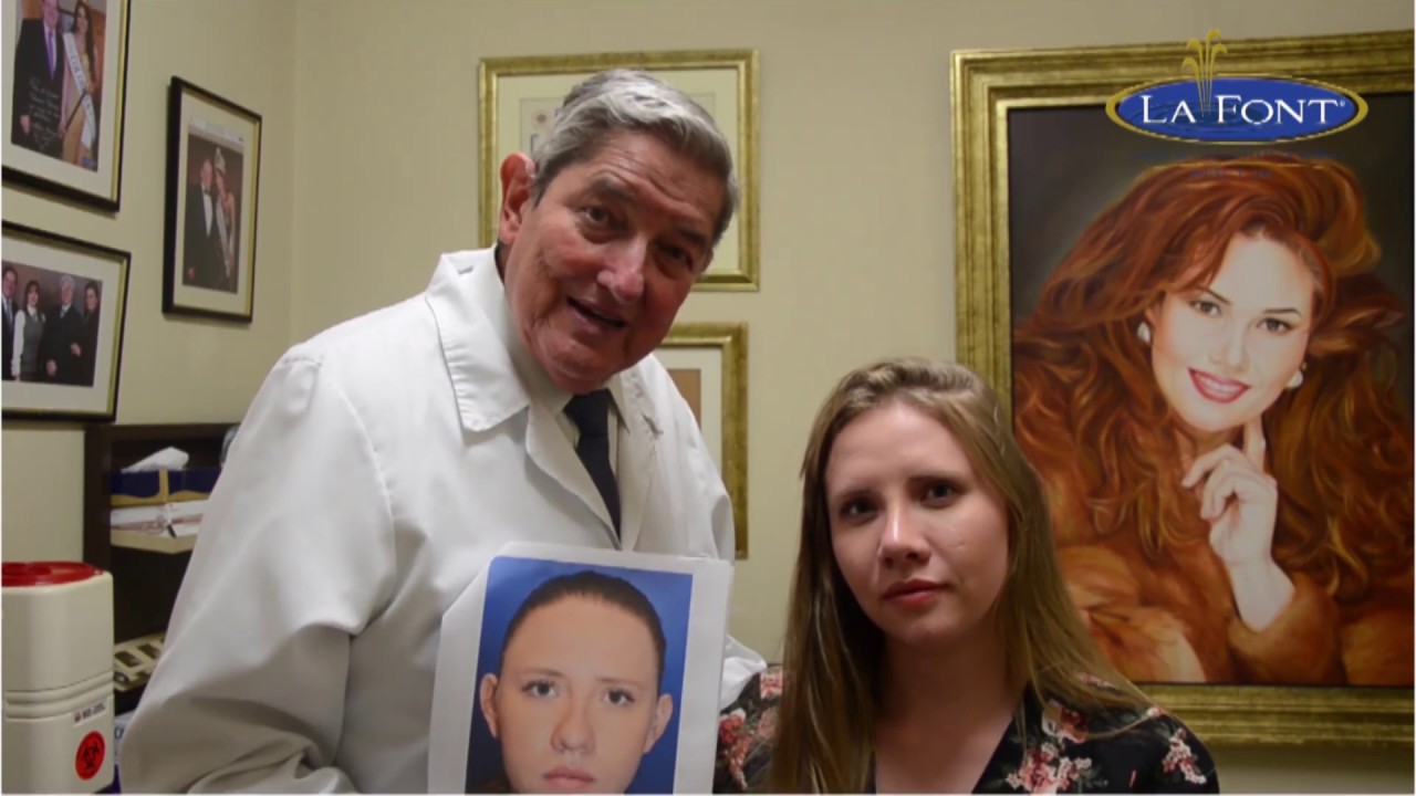 RINOPLASTIA PRIMARIA EN MUJERES JÓVENES - DR. FERNANDO PEDROZA - BOGOTÀ, COLOMBIA