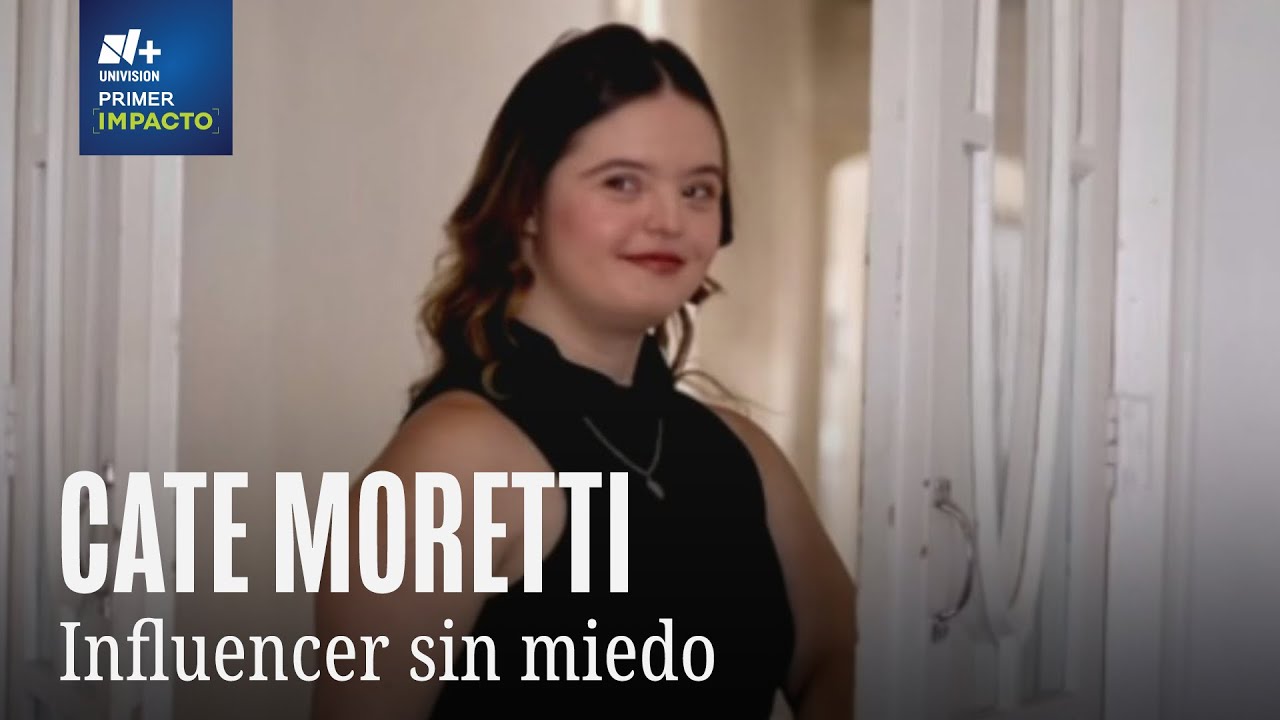 ¿Contratar a una persona con síndrome de down?
