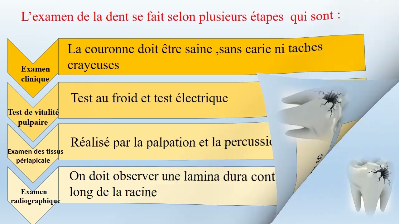 Pulpite réversible vs hypersensibilité dentinaire : comment faire la différence ?
