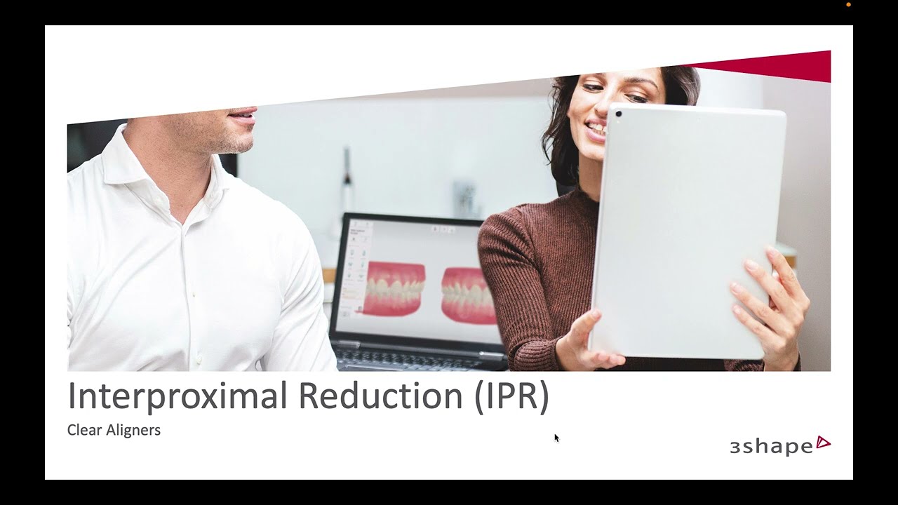 3Shape Design Service - All About IPR for Clear Aligners