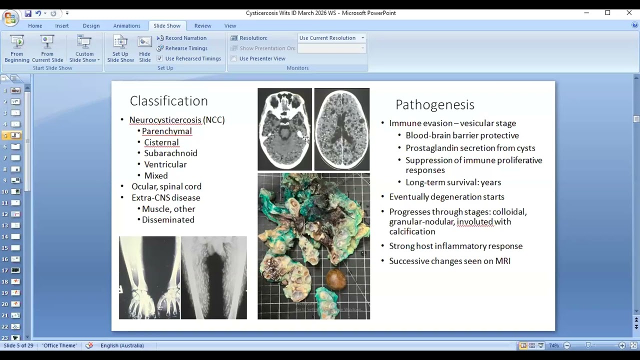Цистицеркоз - Профессор Джон Фрин