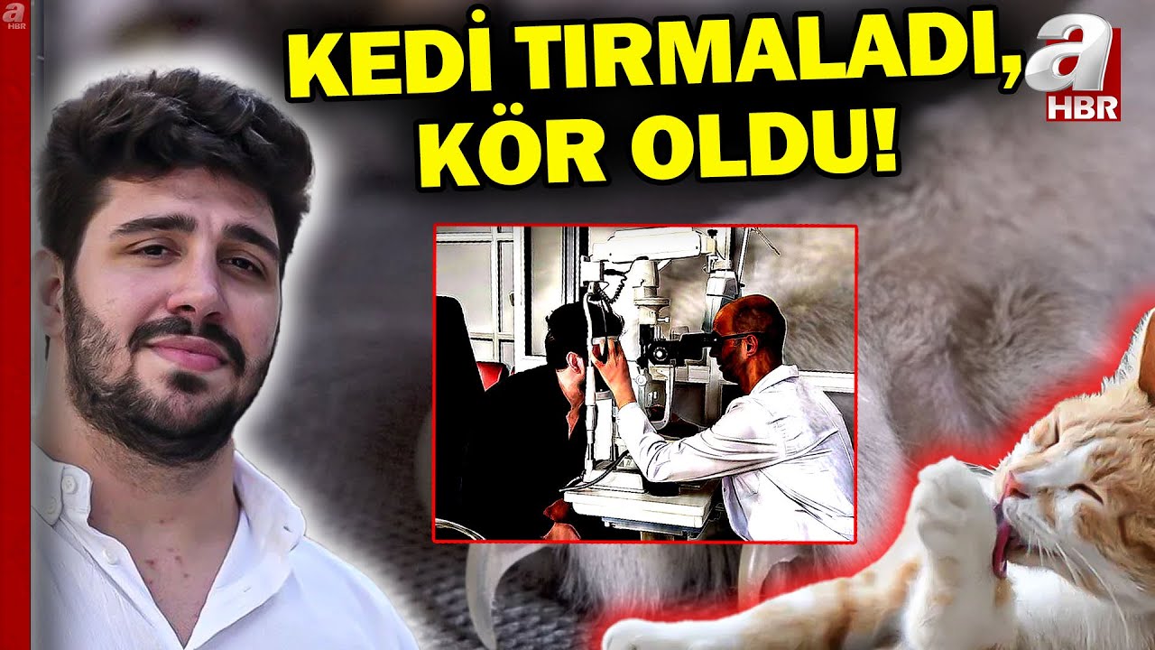 Tırmık Atan Kediden Bakteri Bulaştı, Kör Oldu! | A Haber