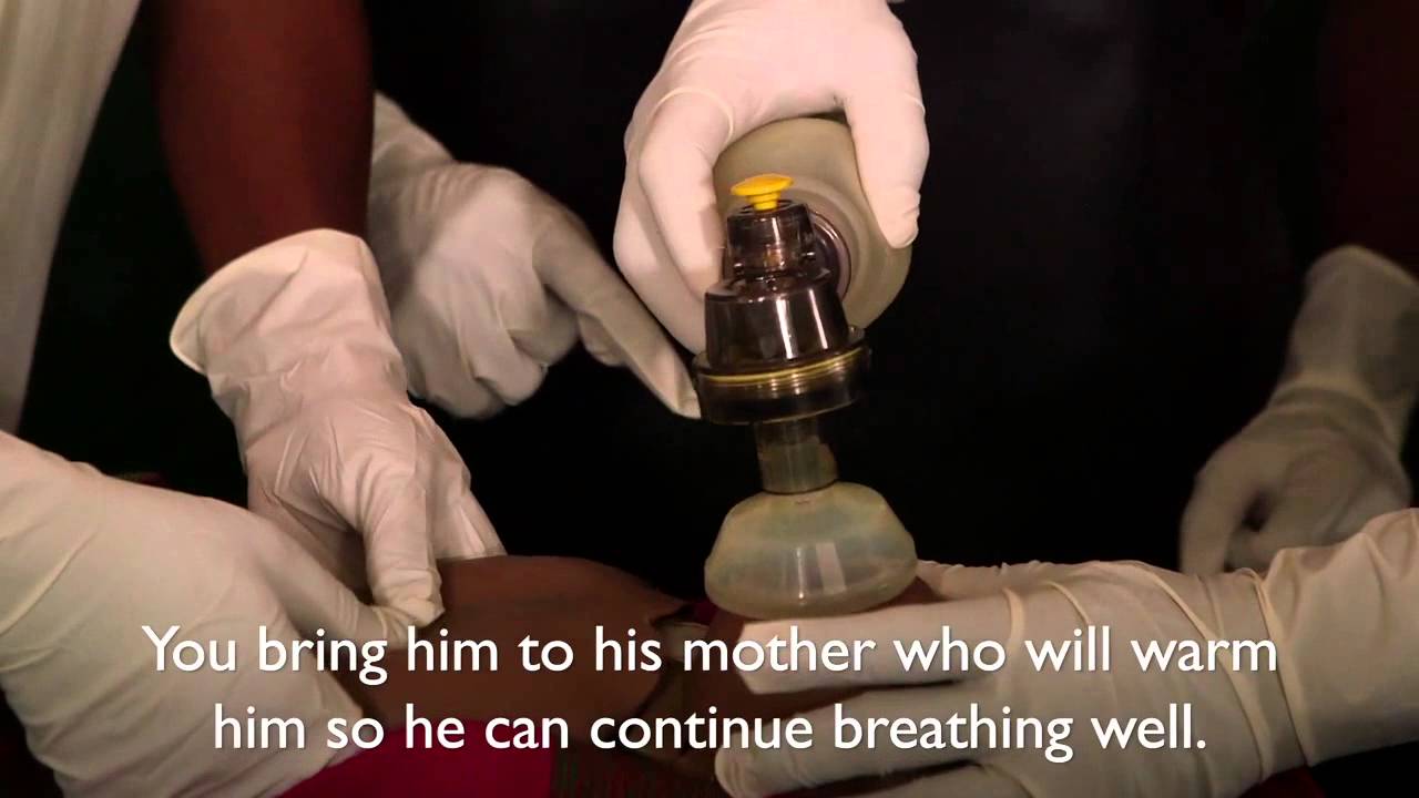 Helping Babies Breath HD