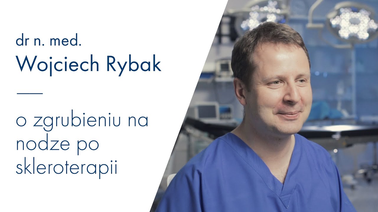 Czym jest zgrubienie na nodze po skleroterapii?
