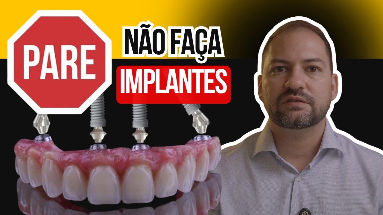 O que muitos dentistas não te explicam.
