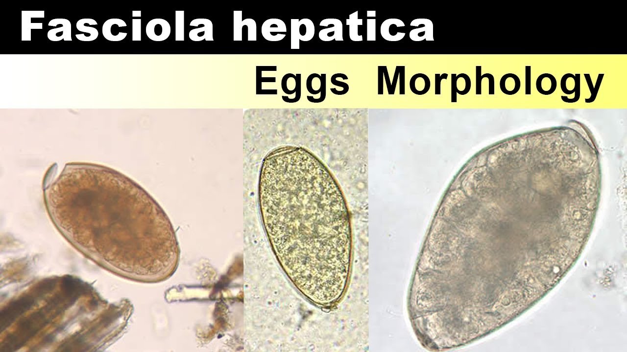 Fasciola Hepatica Eggs  Morphology