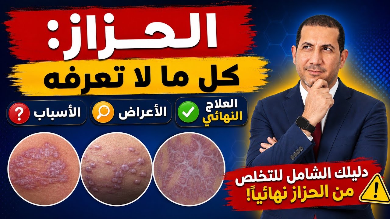 الحزاز الاسباب والأعراض والأنواع والتشخيص والعلاج والنصائح Lichen Planus #سامح_البكري