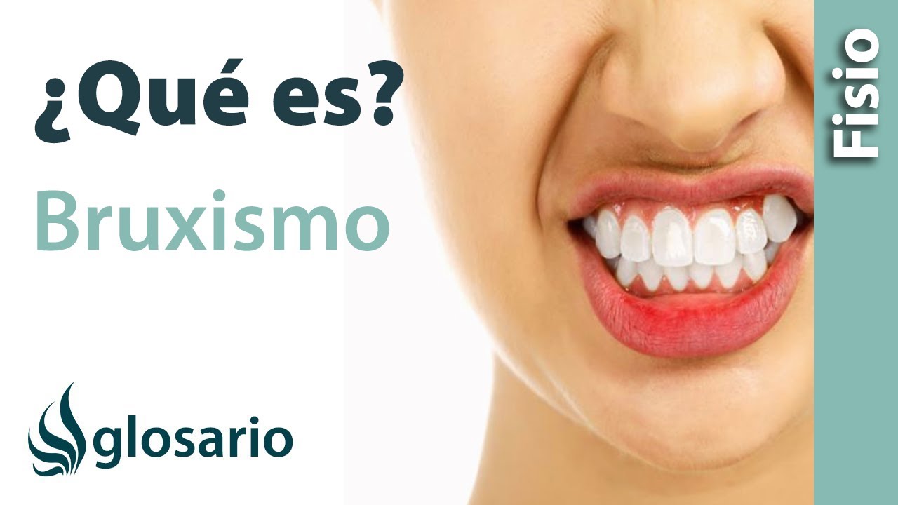 BRUXISMO | &iquest;Qu&eacute; es?