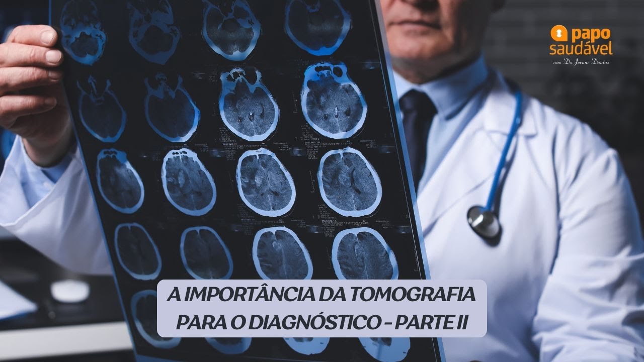 PODCAST PAPO SAUDÁVEL (A IMPORTÂNCIA DA TOMOGRAFIA II) - 04/02/2026