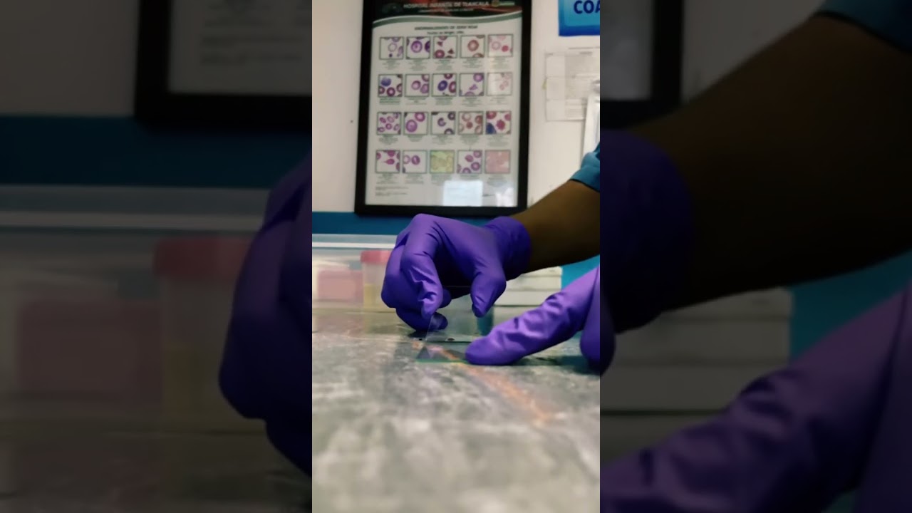 Pasos para hacer un frotis sangu&iacute;neo. F&aacute;cil y r&aacute;pido #Hematologia #frotissanguineo #extendido