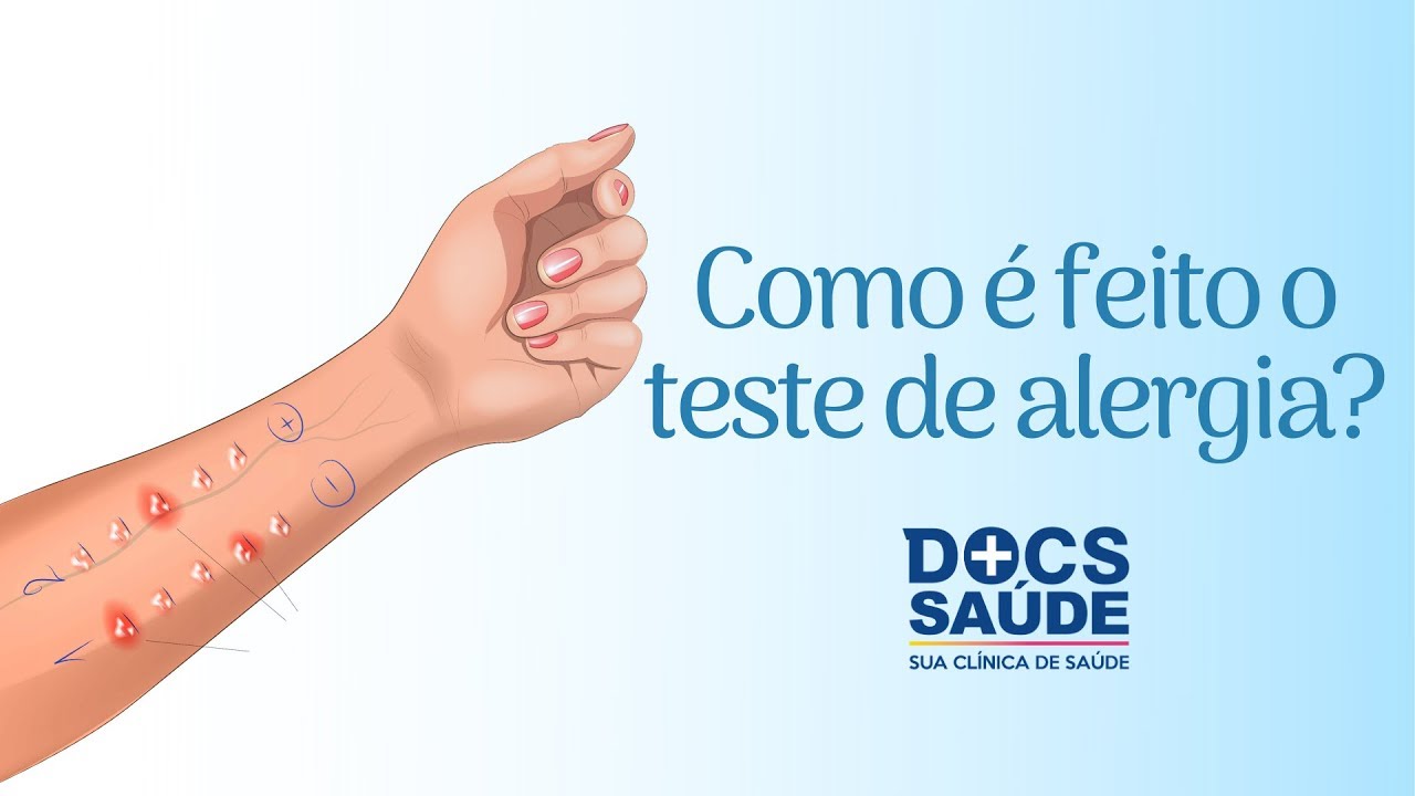 Como &eacute; feito o teste de alergia?