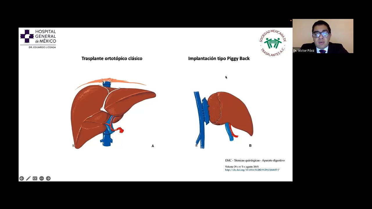 Introducción al módulo de Trasplante Hepático