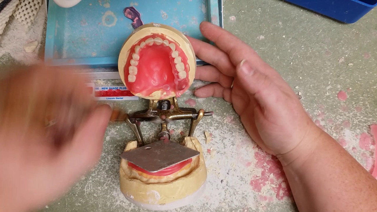 11min Denture Set-up