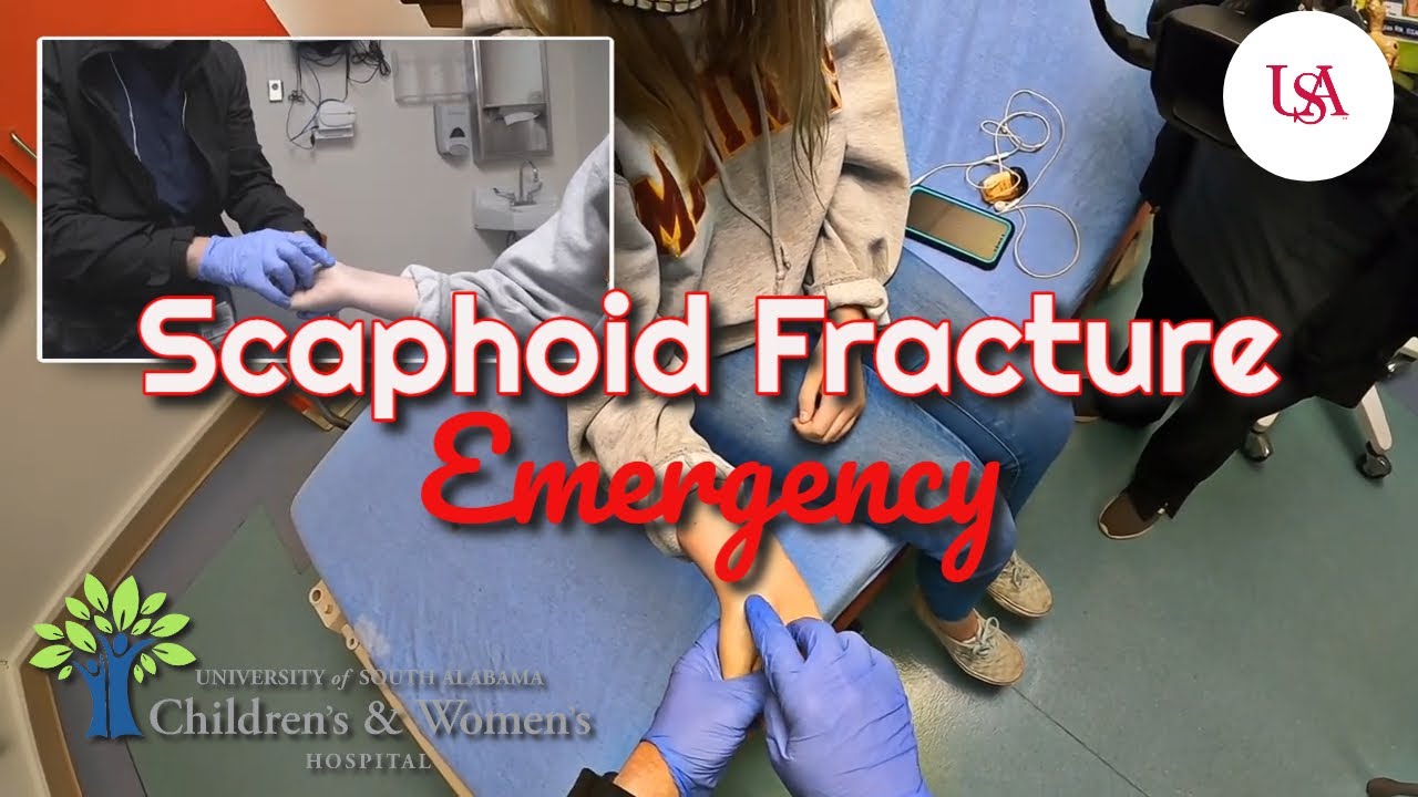 Неотложная помощь при переломе ладьевидной кости