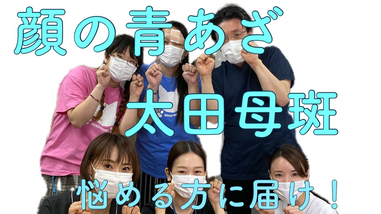【形成外科専門医】顔の青あざ　太田母斑の治し方。服部形成外科・皮ふ科