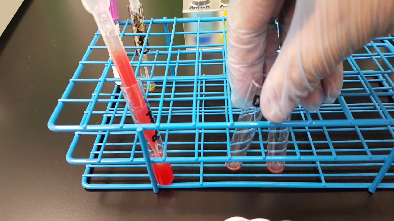 Blood Banking: Weak D test Part 3