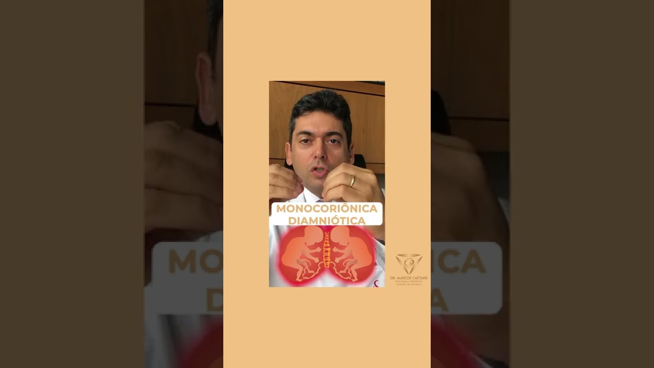 GÊMEOS? Saiba os diferentes tipos de gestação