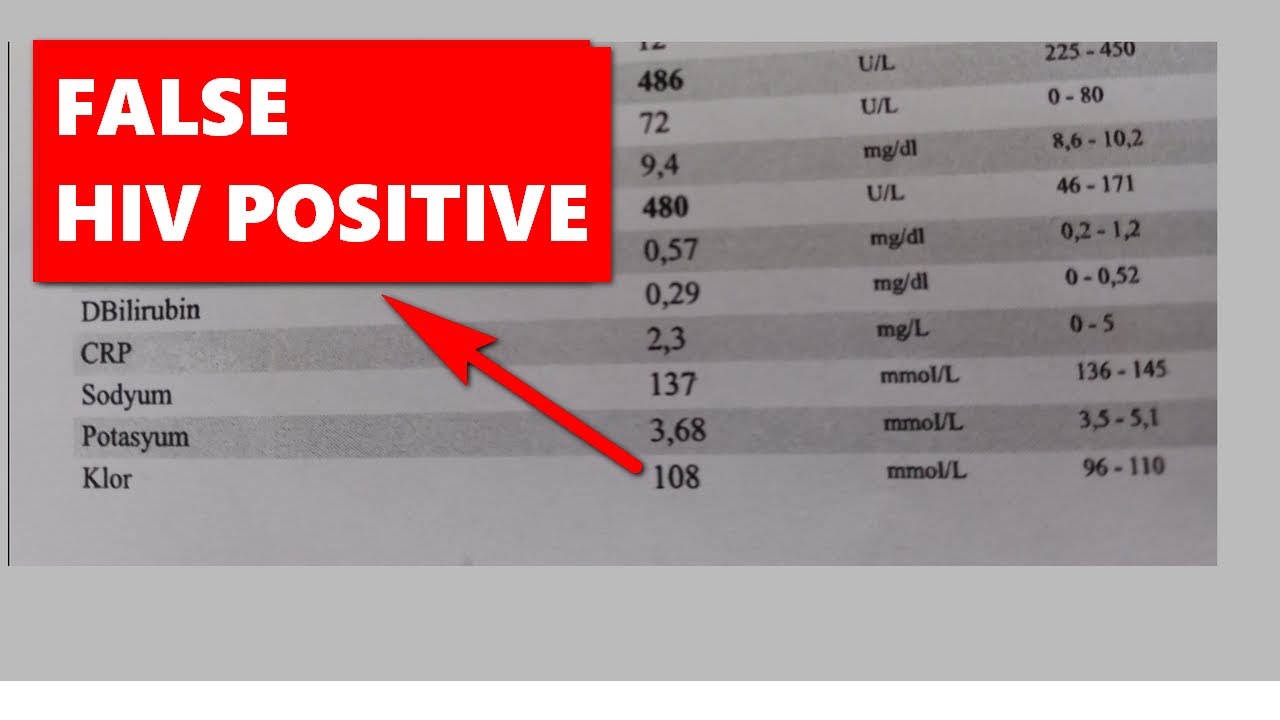 HIV TEST INTERFERENCE! ALL FALSE HIV POSITIVE REASONS!