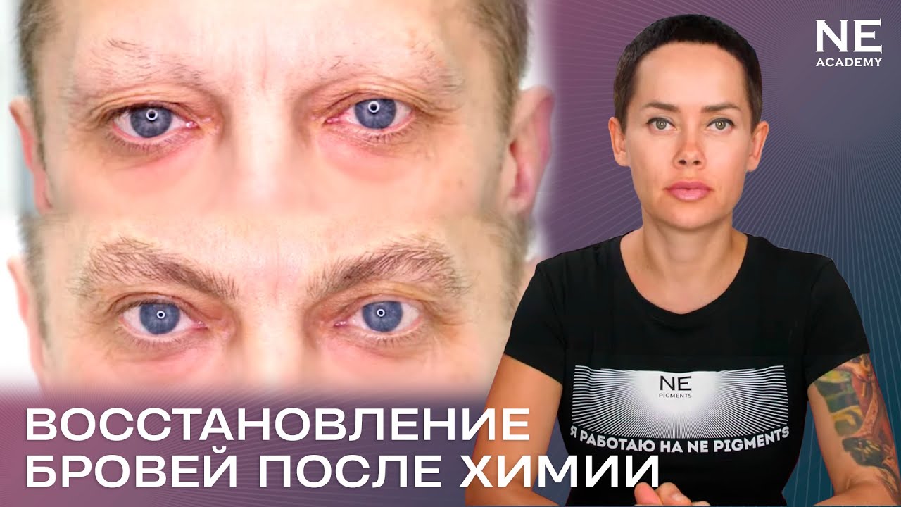 Восстановление бровей после химиотерапии. #татуаж мужчинам