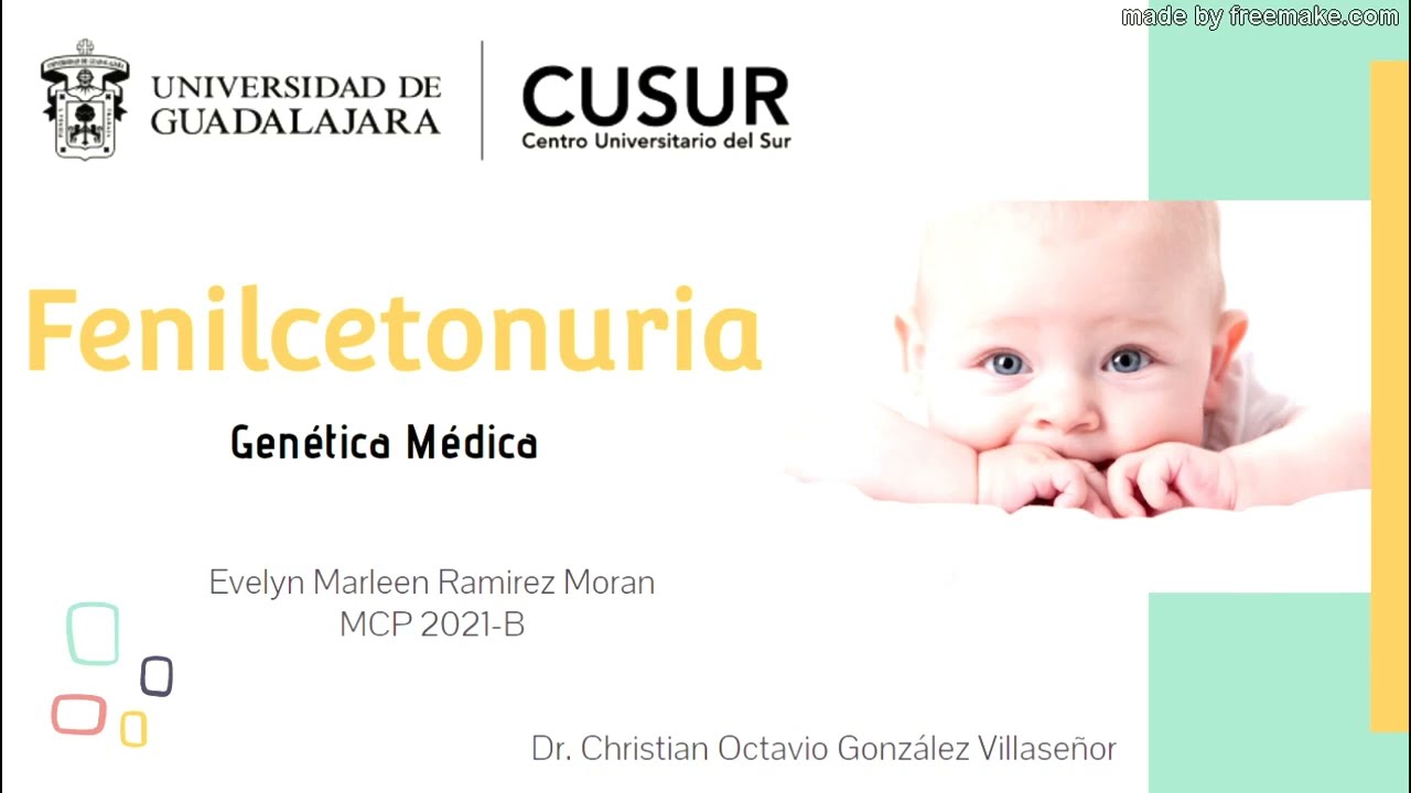 Fenilcetonuria