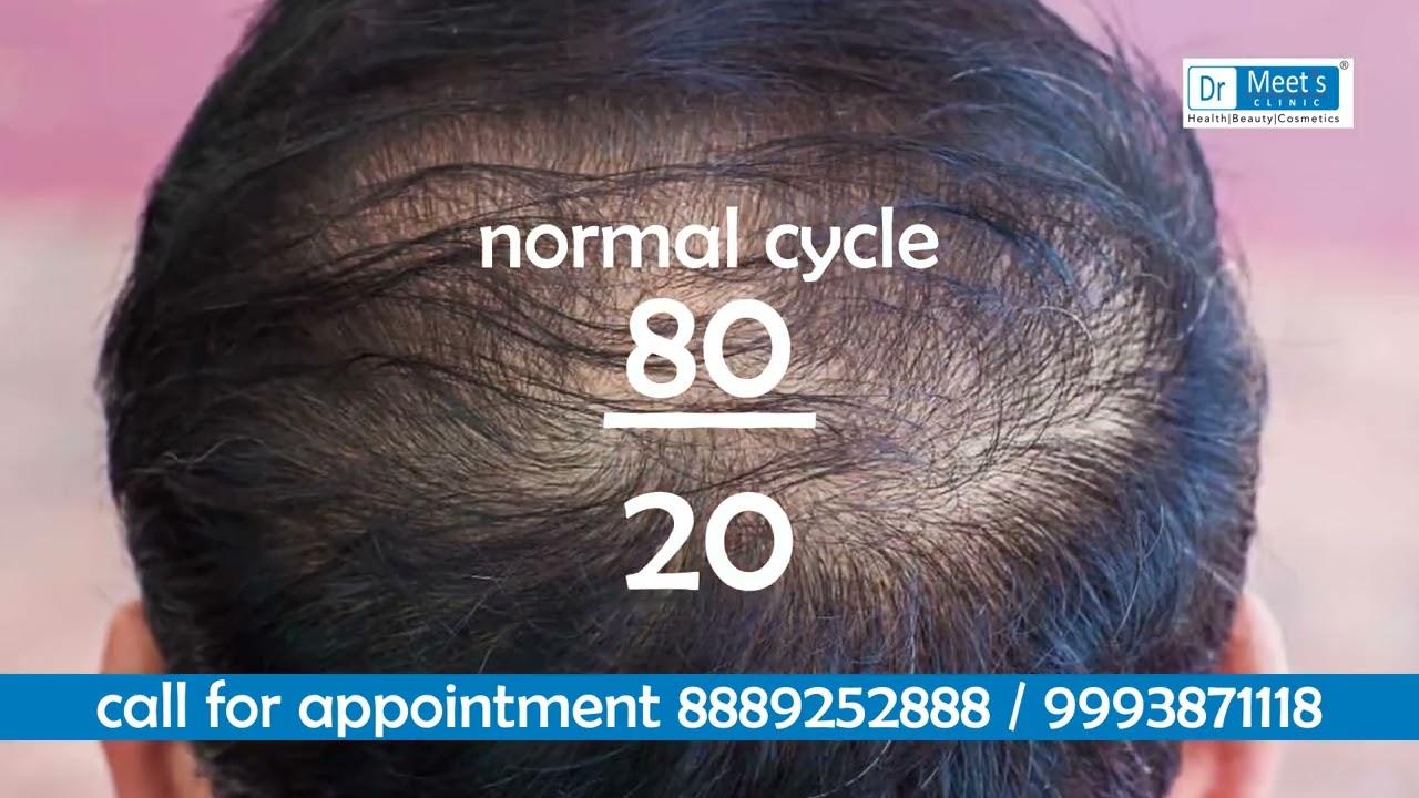 Noticing sudden hair shedding? It could be Telogen Effluvium.