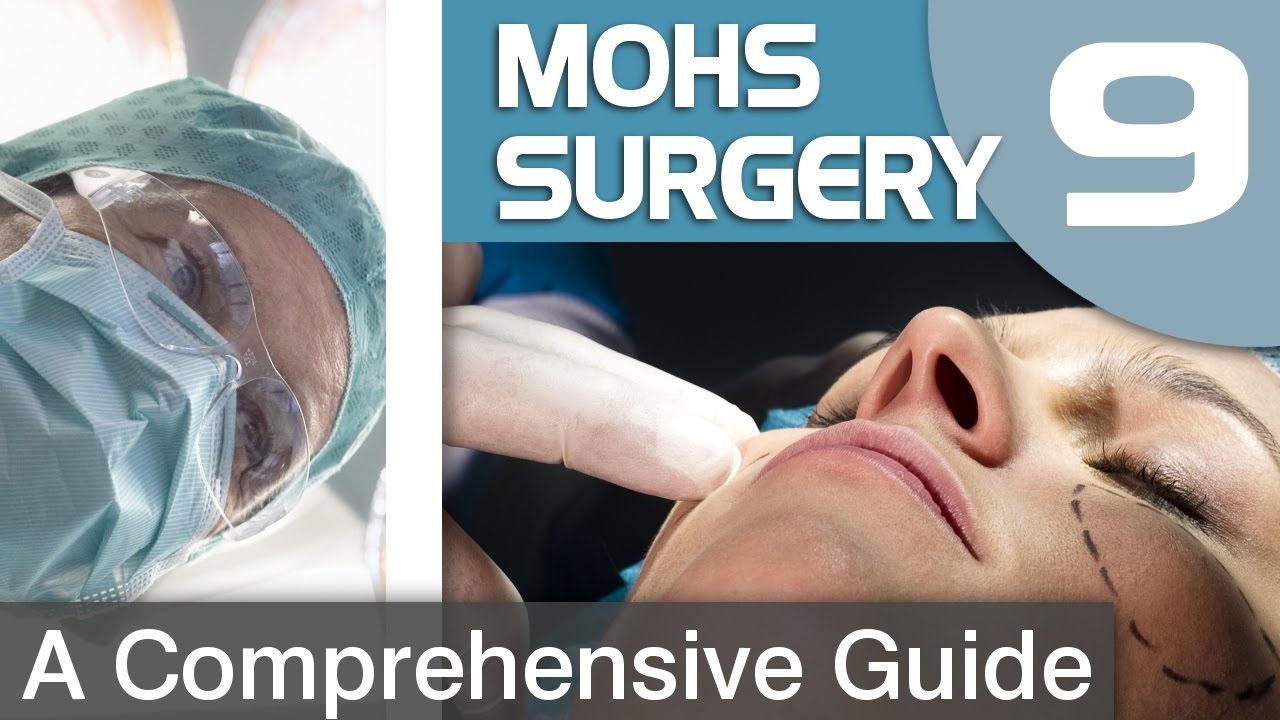 The Recovery Process after Mohs Surgery