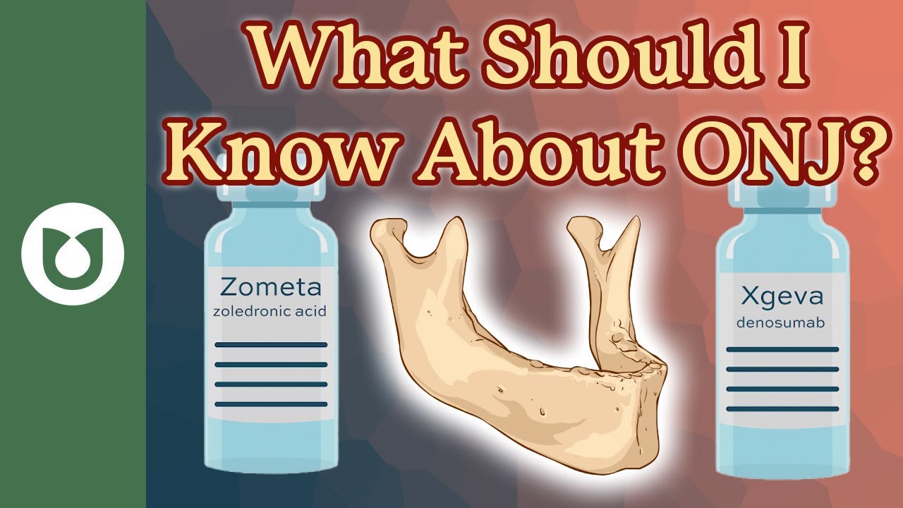 Why is a dentist visit  recommended before starting bone strengthening treatment? #ONJ explained