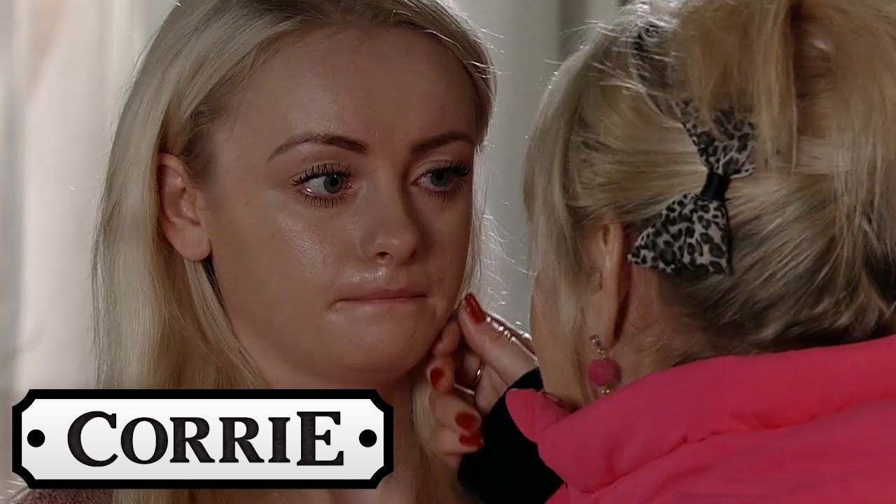 Coronation Street - Sinead Loses More of Her Hair
