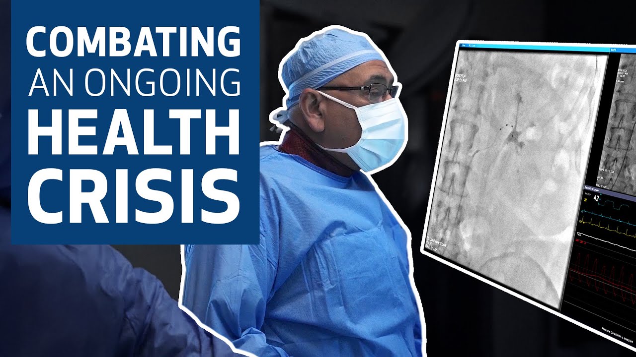 Renal Denervation for Treating Hypertension | Houston Methodist