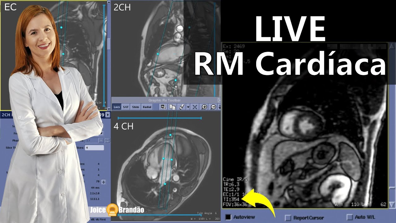 Live - RM Cardíaca