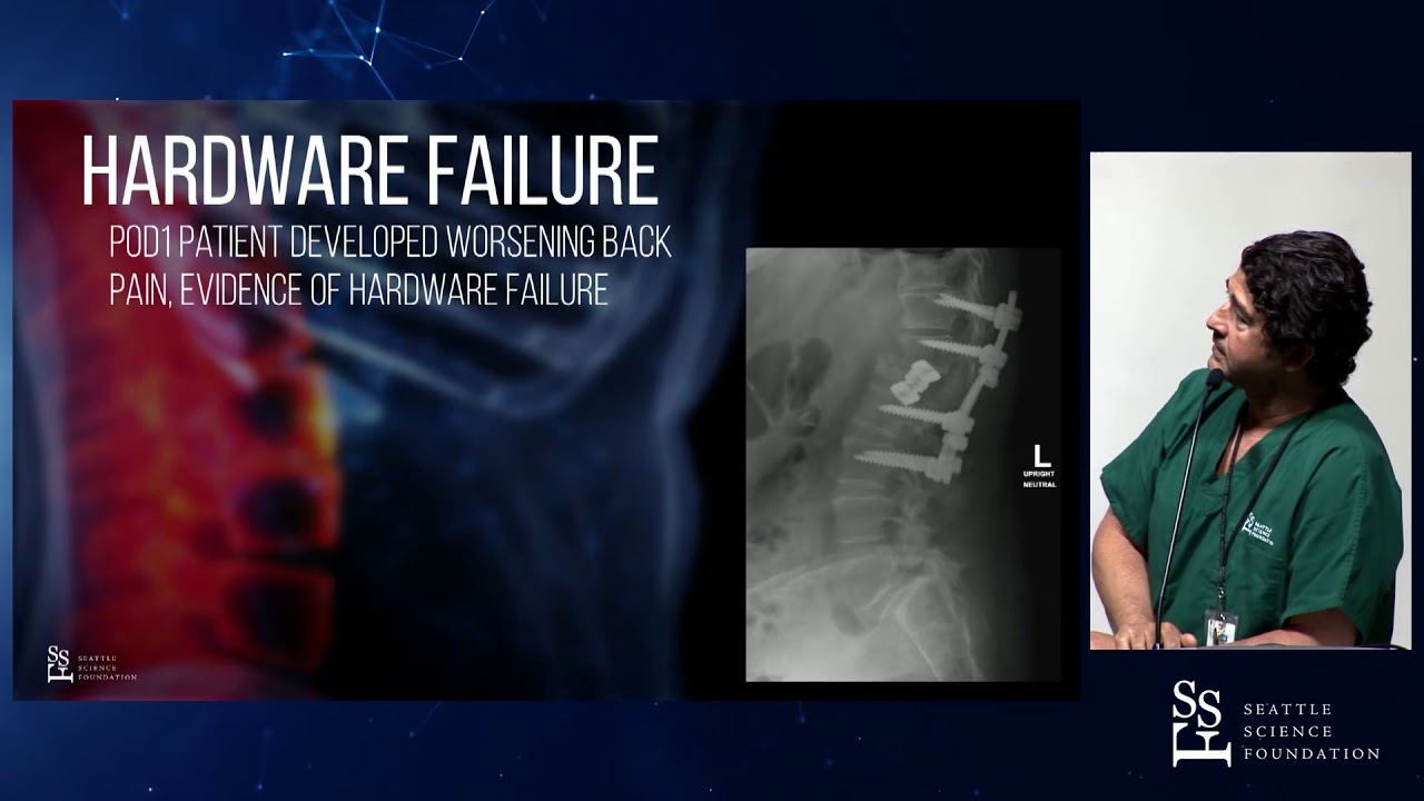 Managing Complex Spine Problems - Rod Oskouian, MD