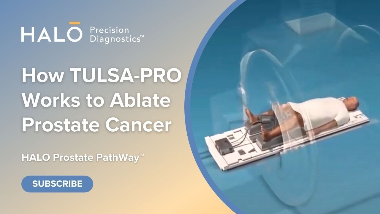 How Does the TULSA Procedure Prostate Cancer Treatment Work? Dr. Karamanian Explains (3D Simulation)