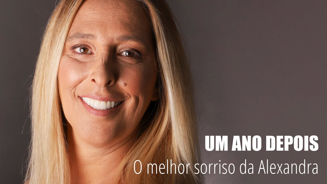 O melhor sorriso da Alexandra - Um ano depois | Clínica Hugo Madeira