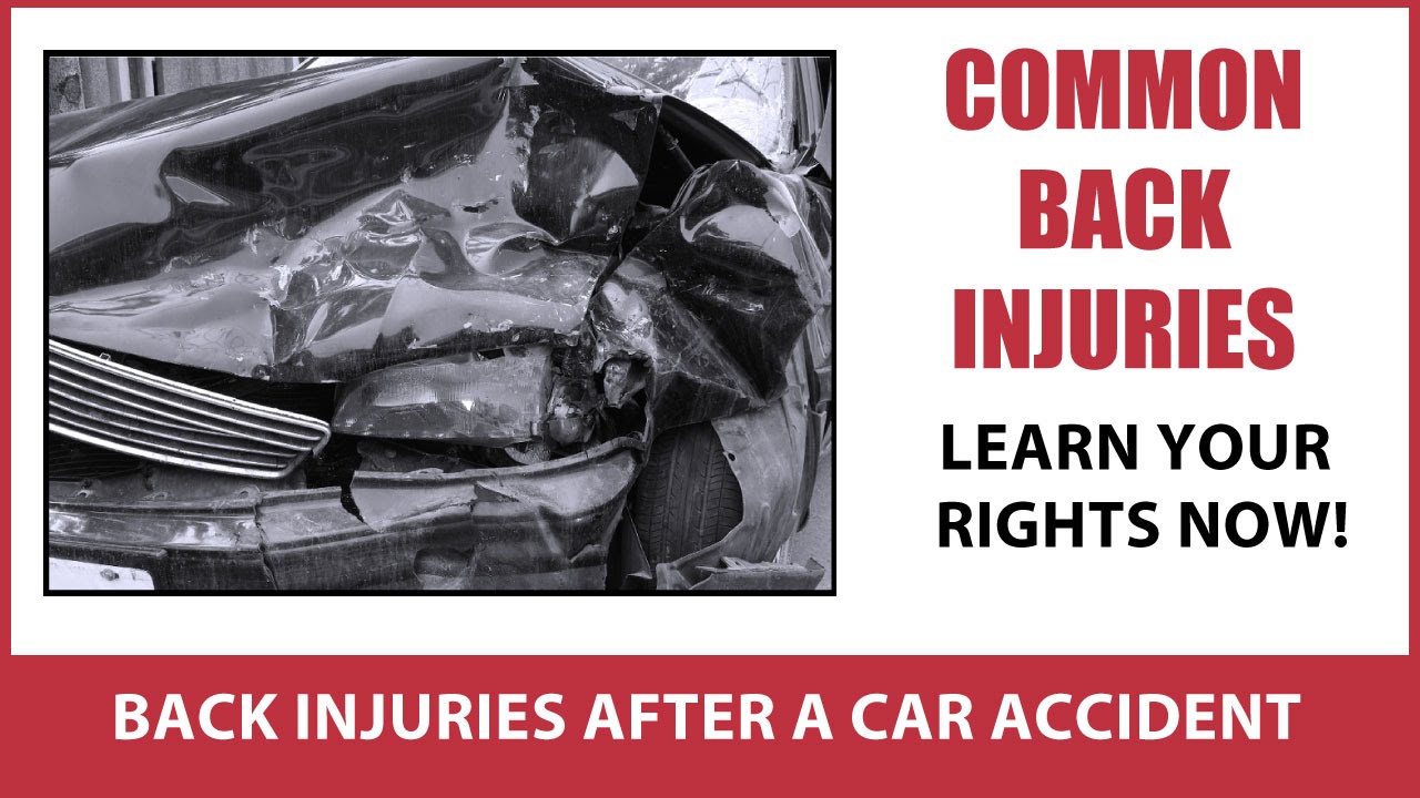 What are some common back injuries after a car accident?