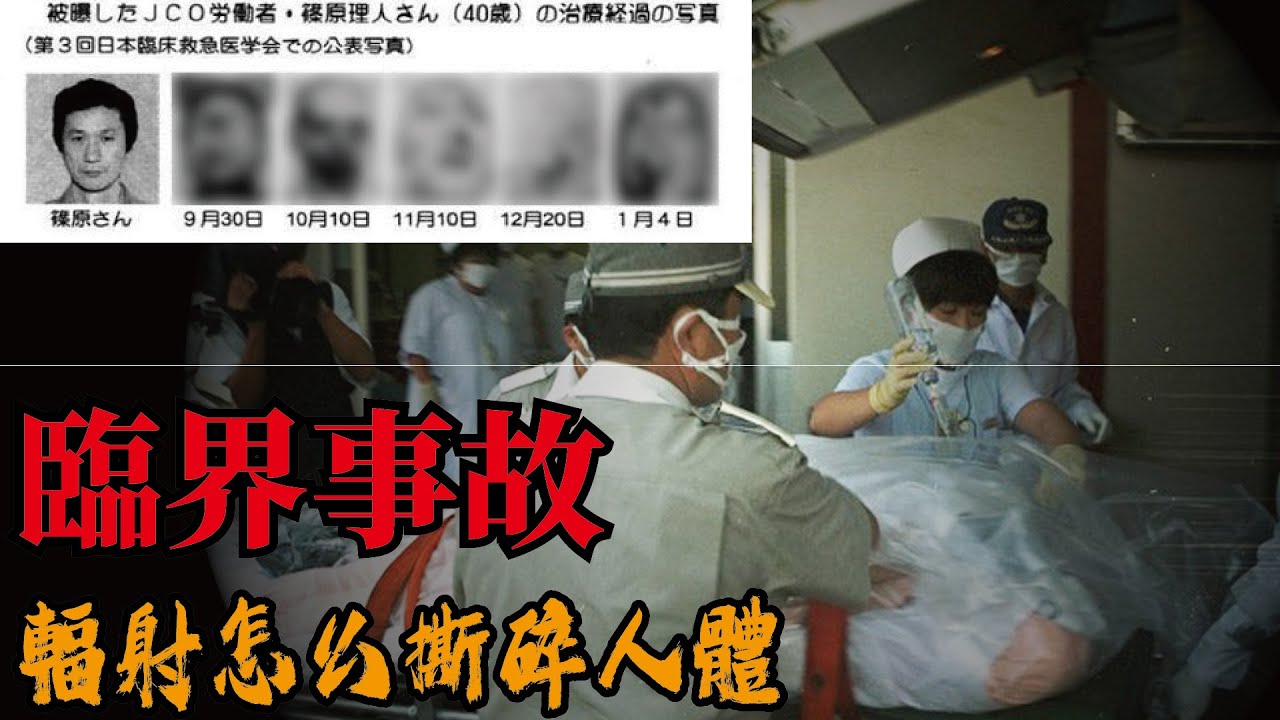25年前日本東海村發生核事故，受害者家屬強烈要求下，治療過程得以全公開，大家這才知道強輻射怎麼把一個健康成年人粉碎掉