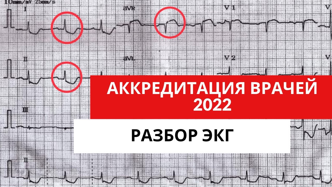 Разбор ЭКГ из АККРЕДИТАЦИИ 2022 года (для кардиологов, терапевтов, функциональных диагностов)Часть 1