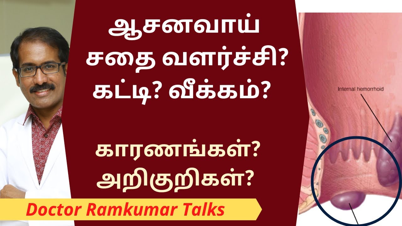 ஆசன வாய் பகுதியில் சதை வளர்ச்சி, வீக்கம், கட்டிகள் வர காரணங்கள் & அறிகுறிகள் என்ன? / ANUS SWELLING?