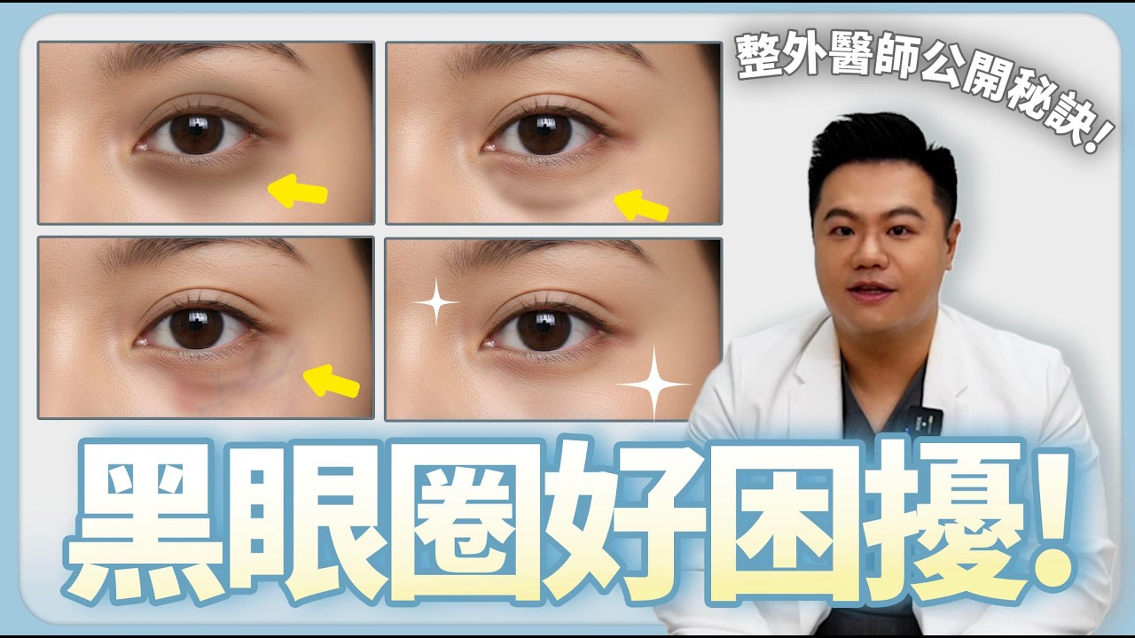 2026眼袋內開移位，眼袋內開移位手術黑眼圈改善效果解析，做完眼袋手術黑眼圈會消失嗎？真相其實是這樣…｜晶心美醫診所、整形外科阮智楷醫師