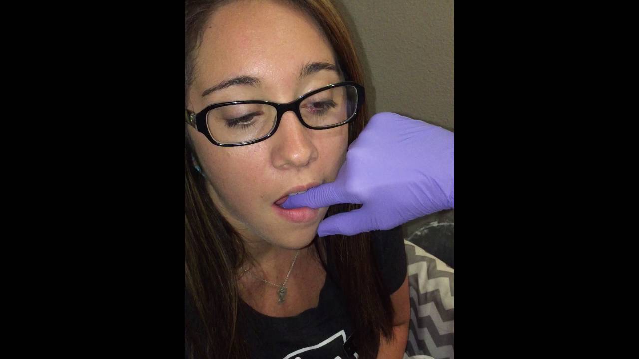 Post Frenectomy Stretches